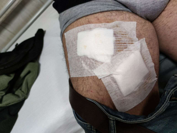 Tarladaki Çiftçi Köpeklerin Saldırısına Uğradı